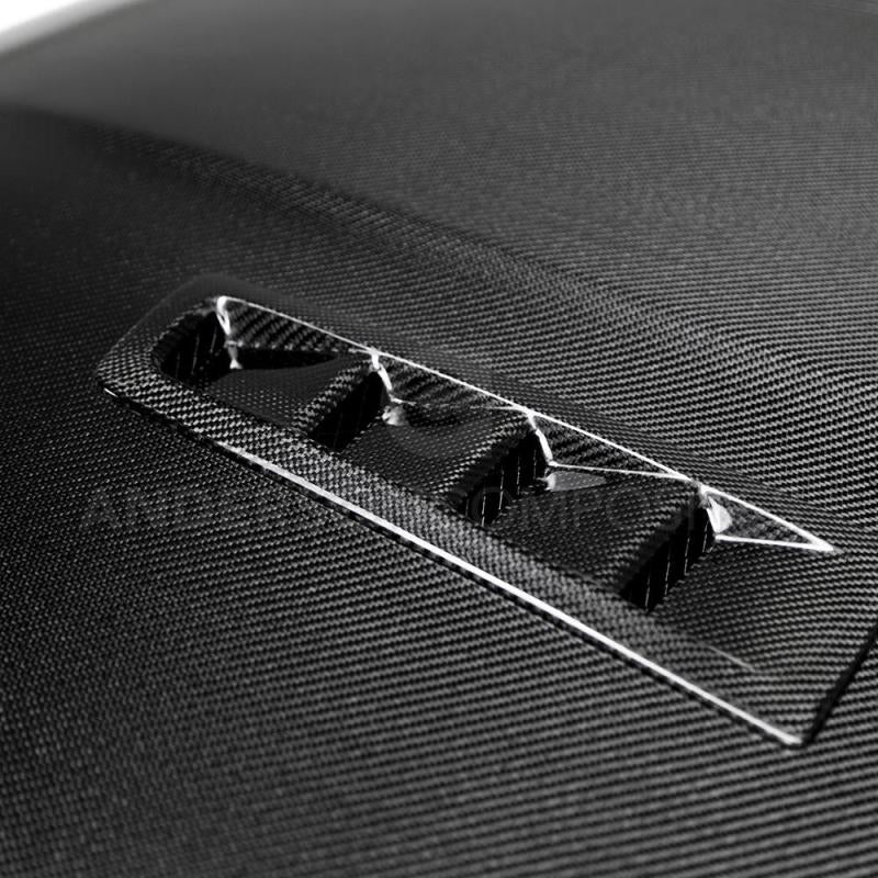 Anderson Composites 2016-2017 Ford Focus ST/RS Carbon Fiber RS Hood AJ-USA, Inc